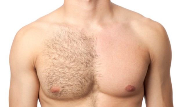 epilation-homme-torse