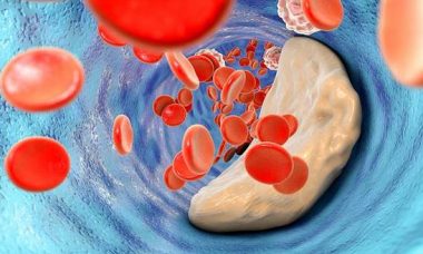 taux-cholesterol-connaitre-prise-de-sang-hdl-ldl-triglycerides