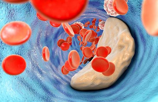 taux-cholesterol-connaitre-prise-de-sang-hdl-ldl-triglycerides